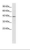 TBX6 Antibody - Jurkat Cell Lysate.  This image was taken for the unconjugated form of this product. Other forms have not been tested.