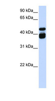 TBX6 Antibody - TBX6 antibody Western blot of Fetal Brain lysate. This image was taken for the unconjugated form of this product. Other forms have not been tested.