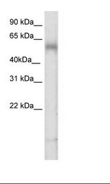 TBX6 Antibody - Placenta Lysate.  This image was taken for the unconjugated form of this product. Other forms have not been tested.