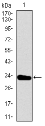 TBXT / T / Brachyury Antibody - Western blot using T monoclonal antibody against human T recombinant protein. (Expected MW is 31.2 kDa)