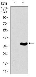 TBXT / T / Brachyury Antibody - Western blot using T monoclonal antibody against HEK293 (1) and T (AA: 257-309)-hIgGFc transfected HEK293 (2) cell lysate.