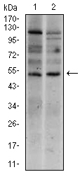 TBXT / T / Brachyury Antibody - Western blot using T mouse monoclonal antibody against Raji (1), and Jurkat (2) cell lysate.