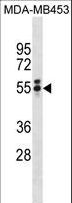 TBXT / T / Brachyury Antibody - T Antibody western blot of MDA-MB453 cell line lysates (35 ug/lane). The T antibody detected the T protein (arrow).