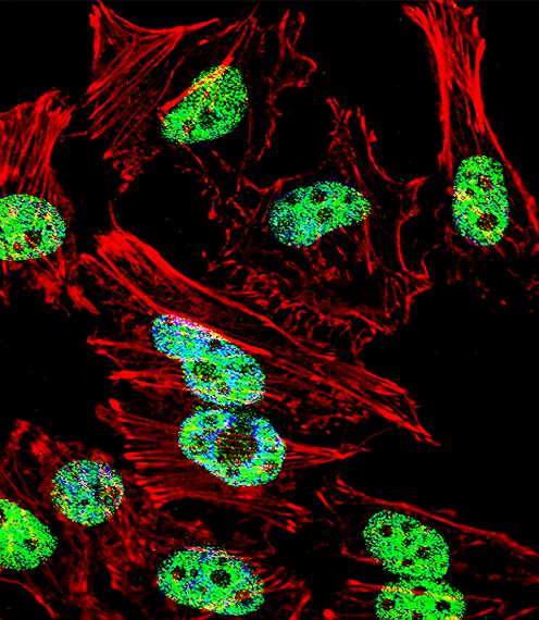 TBXT / T / Brachyury Antibody - Fluorescent confocal image of HeLa cell stained with T Antibody. HeLa cells were fixed with 4% PFA (20 min), permeabilized with Triton X-100 (0.1%, 10 min), then incubated with T primary antibody (1:25, 1 h at 37°C). For secondary antibody, Alexa Fluor 488 conjugated donkey anti-rabbit antibody (green) was used (1:400, 50 min at 37°C). Cytoplasmic actin was counterstained with Alexa Fluor 555 (red) conjugated Phalloidin (7units/ml, 1 h at 37°C). Nuclei were counterstained with DAPI (blue) (10 ug/ml, 10 min). T immunoreactivity is localized to Nucleus significantly.