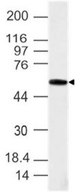 TBXT / T / Brachyury Antibody - Fig-1: Western blot analysis of Brachyury. Anti-Brachyury antibody was used at 4 µg/ml on Testis lysate.
