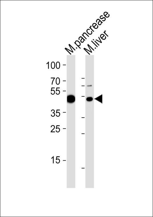 TBXT / T / Brachyury Antibody - Western blot of lysates from mouse pancreas and mouse liver tissue lysate (from left to right) with Mouse T Antibody. Antibody was diluted at 1:1000 at each lane. A goat anti-rabbit IgG H&L (HRP) at 1:5000 dilution was used as the secondary antibody. Lysates at 35 ug per lane.