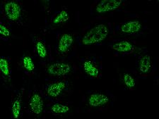 TBXT / T / Brachyury Antibody - Immunofluorescence staining of TBXT in Hela cells. Cells were fixed with 4% PFA, permeabilzed with 0.1% Triton X-100 in PBS, blocked with 10% serum, and incubated with mouse anti-Human T monoclonal antibody (dilution ratio 1:60) at 4°C overnight. Then cells were stained with the Alexa Fluor 488-conjugated Goat Anti-mouse IgG secondary antibody (green). Positive staining was localized to Nucleus.