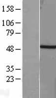TBXT / T / Brachyury Protein - Western validation with an anti-DDK antibody * L: Control HEK293 lysate R: Over-expression lysate