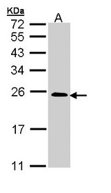 TC21 / RRAS2 Antibody - Sample (30 ug of whole cell lysate). A: A431 . 12% SDS PAGE. TC21 / RRAS2 antibody diluted at 1:5000