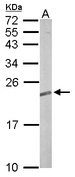 TC21 / RRAS2 Antibody - Sample (50 ug of whole cell lysate). A: mouse brain. 12% SDS PAGE. TC21 / RRAS2 antibody diluted at 1:5000.