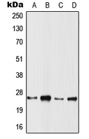 TC21 / RRAS2 Antibody - Western blot analysis of RRAS2 expression in Jurkat (A); A431 (B); MCF7 (C); SP2/0 (D) whole cell lysates.