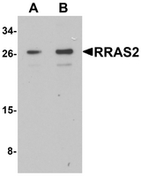 TC21 / RRAS2 Antibody - Western blot analysis of RRAS2 in Jurkat cell lysate with RRAS2 antibody at (A) 1 and (B) 2 ug/ml