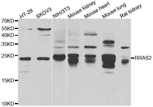 TC21 / RRAS2 Antibody - Western blot analysis of extracts of various cell lines.