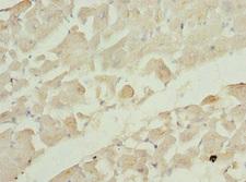 TC21 / RRAS2 Antibody - Immunohistochemistry of paraffin-embedded human heart tissue at dilution 1:100