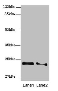 TC21 / RRAS2 Antibody - Western blot All Lanes: RRAS2antibody at 2.66ug/ml Lane 1 : NIH/3T3 whole cell lysate Lane 2 : A431 whole cell lysate Secondary Goat polyclonal to Rabbit IgG at 1/10000 dilution Predicted band size: 24,16,20,25 kDa Observed band size: 23 kDa