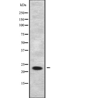 TC21 / RRAS2 Antibody - Western blot analysis of RRAS2 using HuvEc whole cells lysates