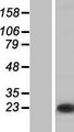 TC21 / RRAS2 Protein - Western validation with an anti-DDK antibody * L: Control HEK293 lysate R: Over-expression lysate