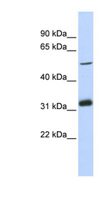 TC2N Antibody - TC2N antibody Western blot of MCF7 cell lysate. This image was taken for the unconjugated form of this product. Other forms have not been tested.