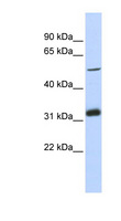 TC2N Antibody - TC2N antibody Western blot of MCF7 cell lysate. This image was taken for the unconjugated form of this product. Other forms have not been tested.