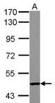 TC2N Antibody - Sample (30 ug of whole cell lysate) A: A549 7.5% SDS PAGE TC2N antibody diluted at 1:1000