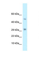 TCAIM Antibody - D9Ertd402e antibody Western blot of Mouse Pancreas lysate. Antibody concentration 1 ug/ml.  This image was taken for the unconjugated form of this product. Other forms have not been tested.