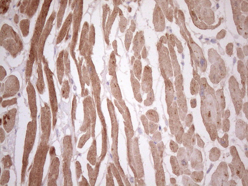 TCAP / Telethonin Antibody - Immunohistochemical staining of paraffin-embedded Human adult heart tissue using anti-TCAP mouse monoclonal antibody. (Heat-induced epitope retrieval by 1 mM EDTA in 10mM Tris, pH8.5, 120C for 3min. (1:150)