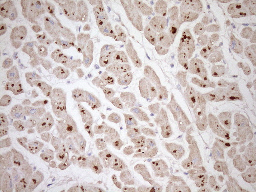 TCAP / Telethonin Antibody - IHC of paraffin-embedded Human adult heart tissue using anti-TCAP mouse monoclonal antibody. (Heat-induced epitope retrieval by Tris-EDTA, pH8.0)(1:150).