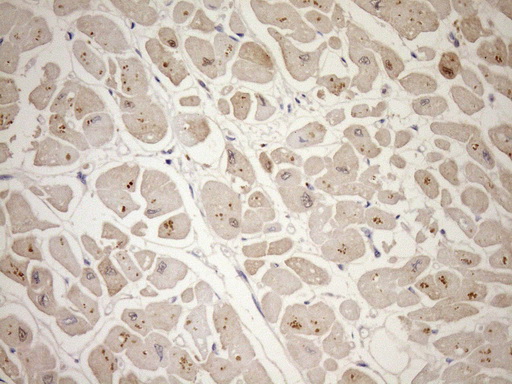 TCAP / Telethonin Antibody - Immunohistochemical staining of paraffin-embedded Human adult heart tissue using anti-TCAP mouse monoclonal antibody. (Heat-induced epitope retrieval by Tris-EDTA, pH8.0)(1:150)