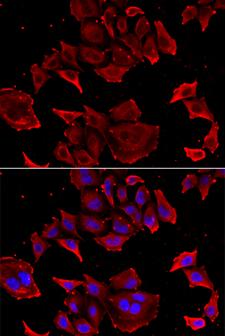 TCAP / Telethonin Antibody - Immunofluorescence analysis of HeLa cells.