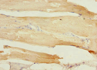 TCAP / Telethonin Antibody - Immunohistochemistry of paraffin-embedded human skeletal muscle tissue at dilution 1:100