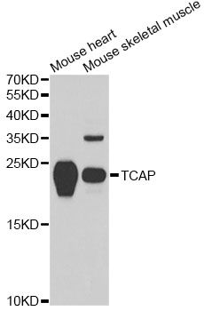 TCAP / Telethonin Antibody - Western blot analysis of extracts of various cell lines, using TCAP antibody at 1:1000 dilution. The secondary antibody used was an HRP Goat Anti-Rabbit IgG (H+L) at 1:10000 dilution. Lysates were loaded 25ug per lane and 3% nonfat dry milk in TBST was used for blocking. An ECL Kit was used for detection and the exposure time was 60s.