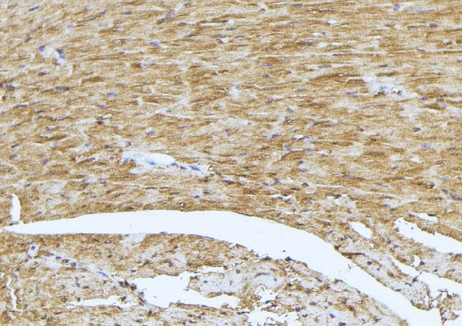 TCAP / Telethonin Antibody - 1:100 staining mouse muscle tissue by IHC-P. The sample was formaldehyde fixed and a heat mediated antigen retrieval step in citrate buffer was performed. The sample was then blocked and incubated with the antibody for 1.5 hours at 22°C. An HRP conjugated goat anti-rabbit antibody was used as the secondary.