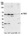 TCBE / KCS / HRD Antibody - Detection of human and mouse TBCE by western blot. Samples: Whole cell lysate (50 µg) from HeLa, HEK293T, Jurkat, mouse TCMK-1, and mouse NIH 3T3 cells prepared using NETN lysis buffer. Antibody: Affinity purified rabbit anti-TBCE antibody used for WB at 0.4 µg/ml. Detection: Chemiluminescence with an exposure time of 30 seconds.