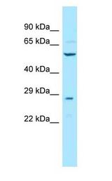 TCBE / KCS / HRD Antibody - KCS / HRD antibody Western Blot of Mouse Liver.  This image was taken for the unconjugated form of this product. Other forms have not been tested.