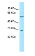 TCBE / KCS / HRD Antibody - KCS / HRD antibody Western Blot of Mouse Liver.  This image was taken for the unconjugated form of this product. Other forms have not been tested.
