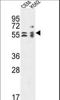 TCBE / KCS / HRD Antibody - TBCE Antibody western blot of CEM,K562 cell line lysates (35 ug/lane). The TBCE antibody detected the TBCE protein (arrow).
