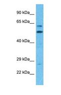 TCBE / KCS / HRD Antibody - Western blot of TBCE Antibody with human 721_B Whole Cell lysate.  This image was taken for the unconjugated form of this product. Other forms have not been tested.