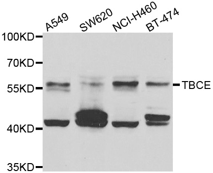 TCBE / KCS / HRD Antibody - Western blot analysis of extracts of various cell lines.
