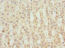 TCBE / KCS / HRD Antibody - Immunohistochemistry of paraffin-embedded human kidney tissue at dilution 1:100