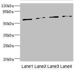 TCBE / KCS / HRD Antibody - Western blot All Lanes: TBCE antibody at 5.55ug/ml Lane 1: CEM whole cell lysate Lane 2: K562 whole cell lysate Lane 3: Hela whole cell lysate Lane 4: Colo320 whole cell lysate Goat polyclonal to Rabbit IgG at 1/10000 dilution Predicted band size: 60,65 kDa Observed band size: 59 kDa