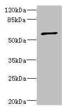 TCBE / KCS / HRD Antibody - Western blot All lanes: TBCE antibody at 5.55µg/ml + CEM whole cell lysate Secondary Goat polyclonal to rabbit IgG at 1/10000 dilution Predicted band size: 60, 65 kDa Observed band size: 60 kDa