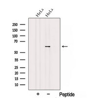TCBE / KCS / HRD Antibody - Western blot analysis of extracts of HeLa cells using TBCE antibody. The lane on the left was treated with blocking peptide.