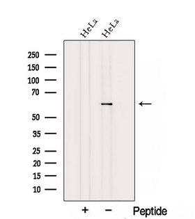 TCBE / KCS / HRD Antibody - Western blot analysis of extracts of HeLa cells using TBCE antibody. The lane on the left was treated with blocking peptide.