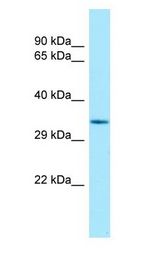 TCEA1 / TFIIS Antibody - TCEA1 / TFIIS antibody Western Blot of Rat Stomach.  This image was taken for the unconjugated form of this product. Other forms have not been tested.
