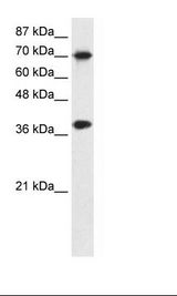 TCEA1 / TFIIS Antibody - Transfected 293T Cell Lysate.  This image was taken for the unconjugated form of this product. Other forms have not been tested.