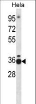 TCEA1 / TFIIS Antibody - TCEA1 Antibody western blot of HeLa cell line lysates (35 ug/lane). The TCEA1 antibody detected the TCEA1 protein (arrow).