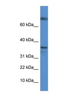 TCEA1 / TFIIS Antibody - TCEA1 antibody Western blot of Mouse Kidney lysate. Antibody concentration 1 ug/ml. This image was taken for the unconjugated form of this product. Other forms have not been tested.