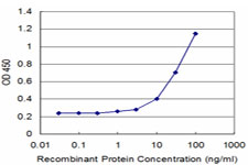 TCEA1 / TFIIS Antibody - Detection limit for recombinant GST tagged TCEA1 is approximately 1 ng/ml as a capture antibody.