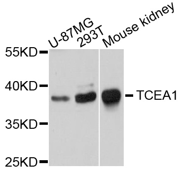 TCEA1 / TFIIS Antibody - Western blot analysis of extracts of various cell lines, using TCEA1 antibody at 1:1000 dilution. The secondary antibody used was an HRP Goat Anti-Rabbit IgG (H+L) at 1:10000 dilution. Lysates were loaded 25ug per lane and 3% nonfat dry milk in TBST was used for blocking. An ECL Kit was used for detection and the exposure time was 30s.