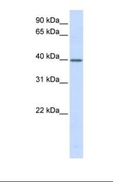 TCEA3 Antibody - Fetal heart lysate. Antibody concentration: 1.0 ug/ml. Gel concentration: 12%.  This image was taken for the unconjugated form of this product. Other forms have not been tested.